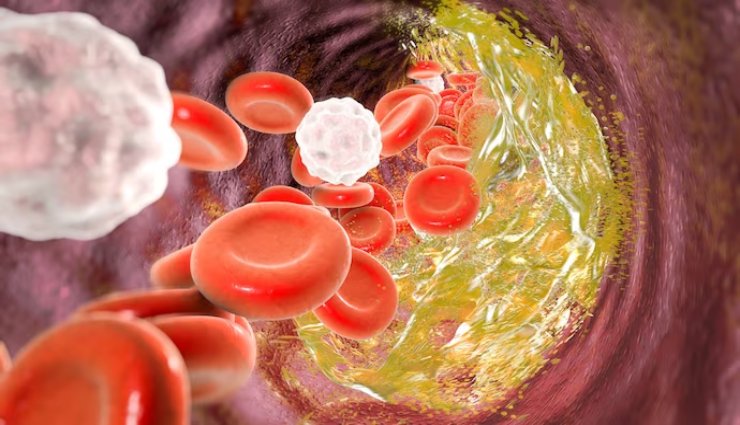 کلسترول خوب (HDL)؛ نقش و فواید آن برای سلامت قلب