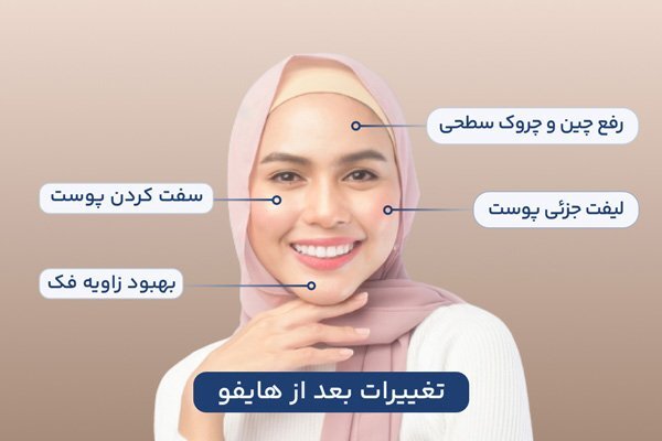 بهترین مارک دستگاه هایفو: راهنمای انتخاب تازه ترین مدل_تمشک 1 بهترین مارک دستگاه هایفو